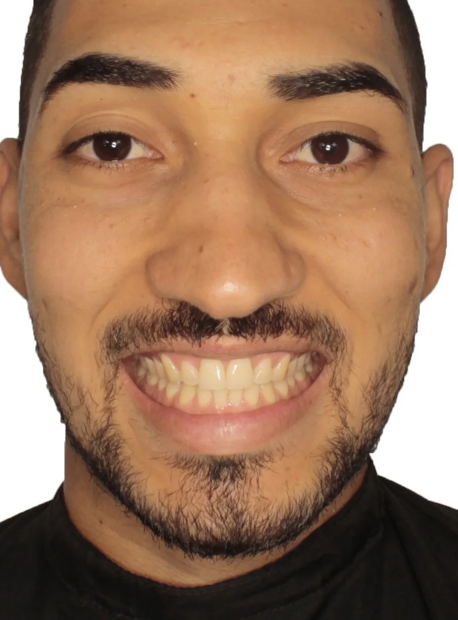 Registro antes do caso clínico 01